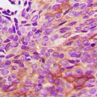 HSPB2 / HSP27 Antibody (C-Terminus)