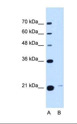 Polyclonal Rabbit anti-Human TMED3 Antibody (FITC, C-Terminus, WB)