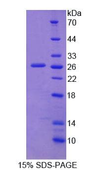 Mouse SRPRB Protein (Recombinant His-T7)