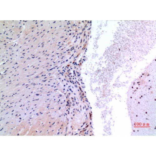Polyclonal Rabbit anti-Human VEGFC Antibody (91-140 aa, Internal, IHC, WB)