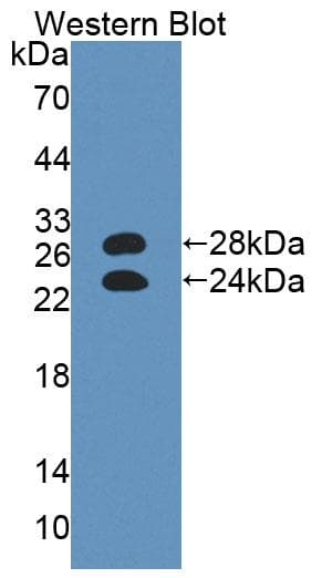 ORM1 / Orosomucoid Antibody (aa19-207)