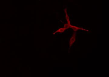 Polyclonal Rabbit anti-Human MINK1 / MINK Antibody (aa400-420, IF, WB)