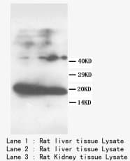 FABP1 / L-FABP Antibody (N-Terminus)