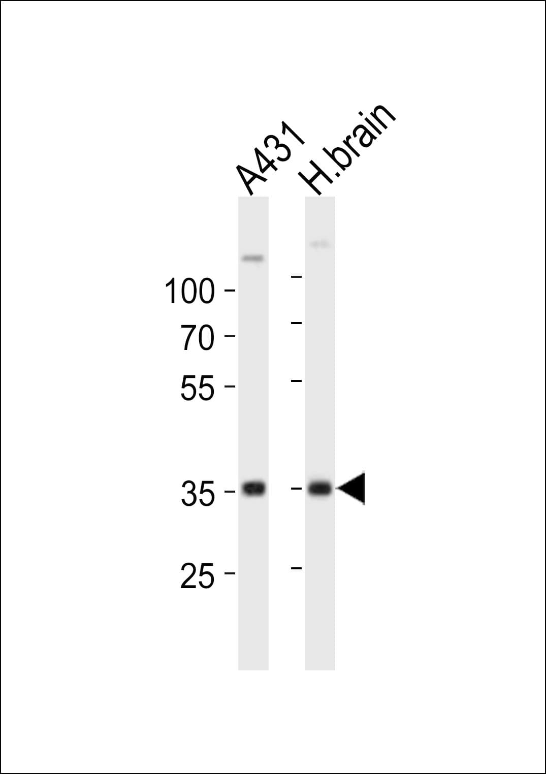 UTF1 Antibody (aa191-224)