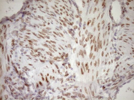 MED15 / ARC105 Antibody (aa393-679, clone OTI1C11)