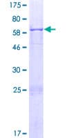 Human CCDC68 Protein (Recombinant GST)