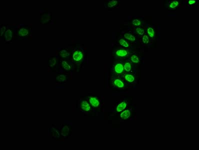 Polyclonal Rabbit anti-Human HIST1H3A Antibody (IHC, WB)