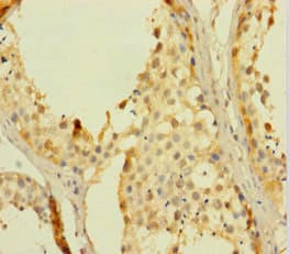 Polyclonal Rabbit anti-Human RHOXF2 Antibody