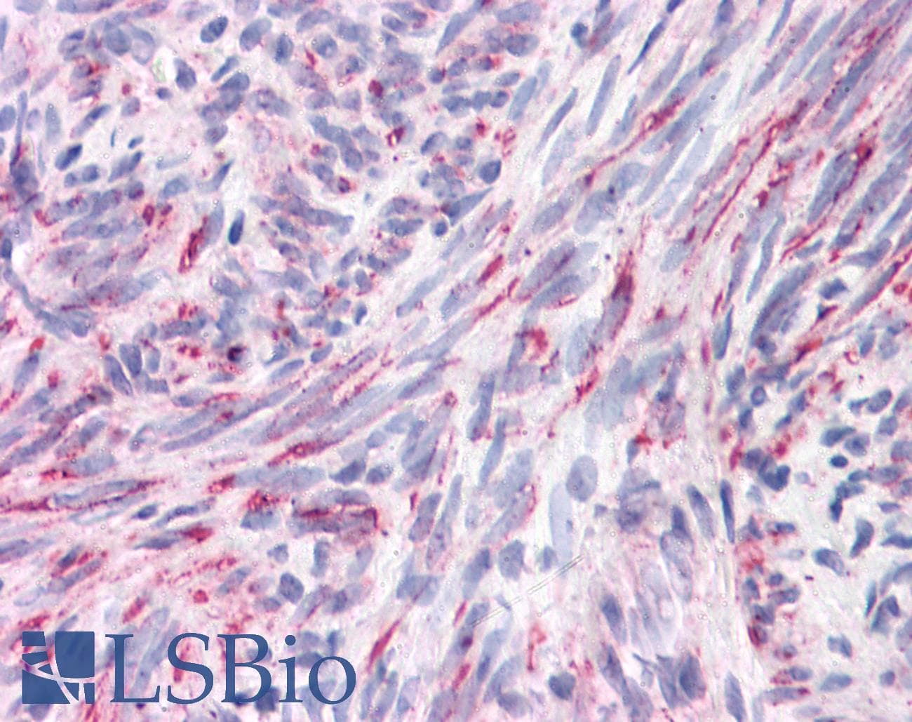 IHC-plus™ APC4 / ANAPC4 Antibody