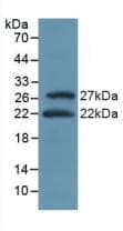 ATF4 Antibody (aa126-291)