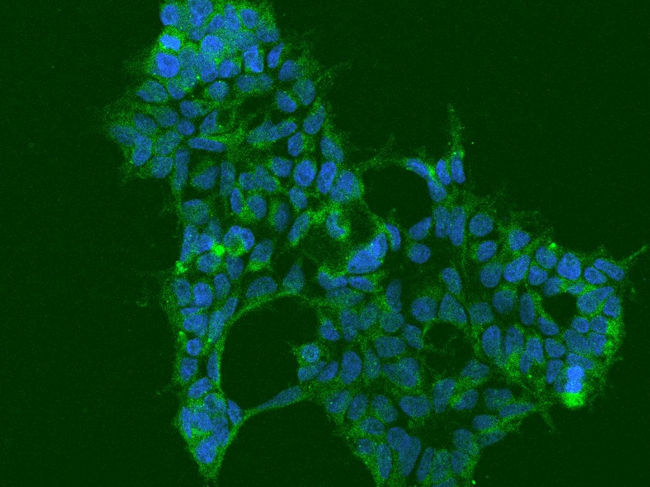 ATXN10 / SCA10 Antibody