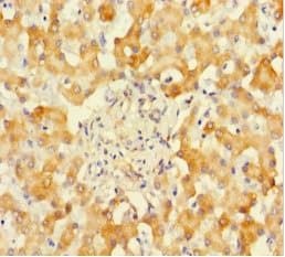 Polyclonal Rabbit anti-Human SUOX / Sulfite Oxidase Antibody (IHC, WB)