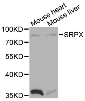 SRPX Antibody