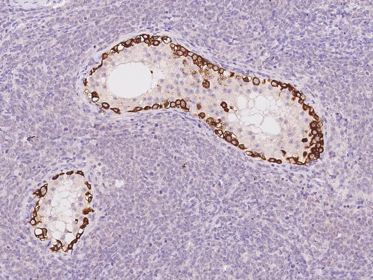 Polyclonal Rabbit anti-Human STK31 Antibody (IHC)