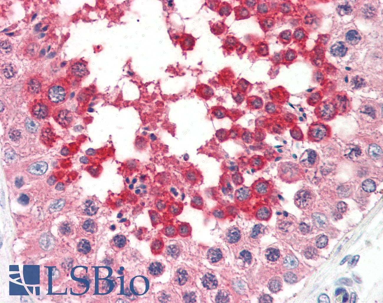 Polyclonal Rabbit anti-Human CASP1 / Caspase 1 Antibody (IHC, WB)