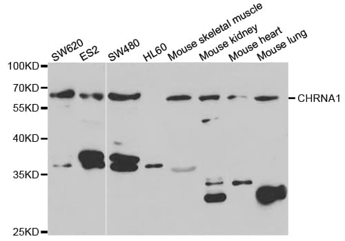 CHRNA1 Antibody