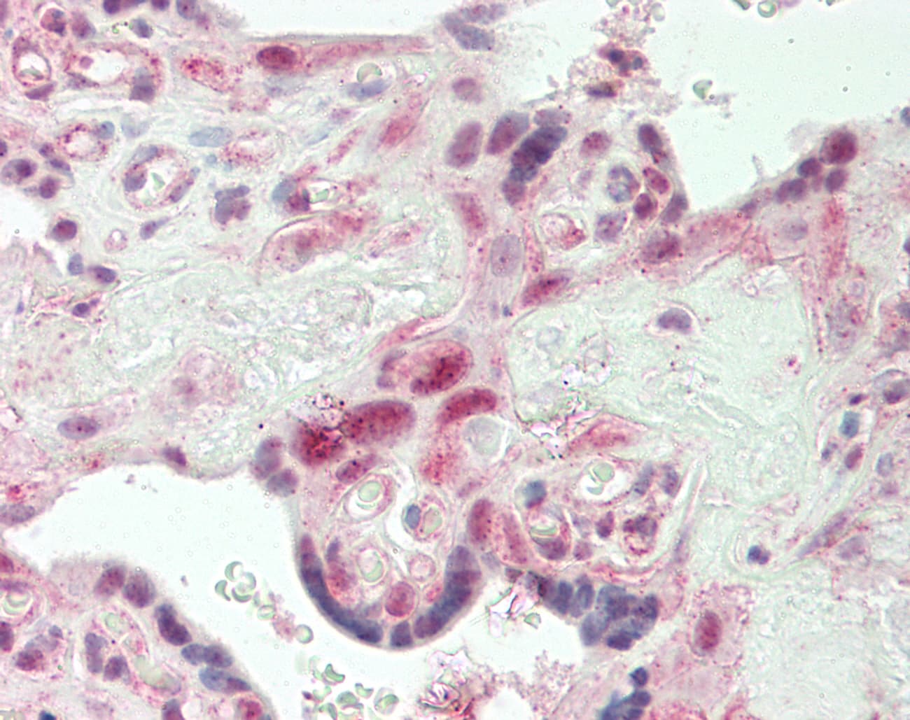 IHC-plus™ Polyclonal Rabbit anti-Human SMARCA4 / BRG1 Antibody (aa1420-1470, IHC, IF, WB)