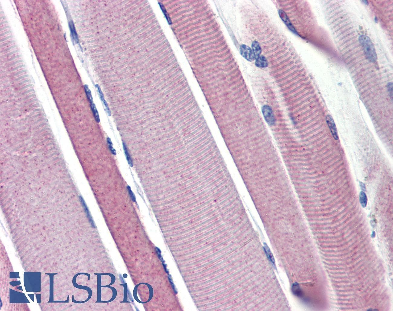 HK2 / Hexokinase 2 Antibody (aa74-123)
