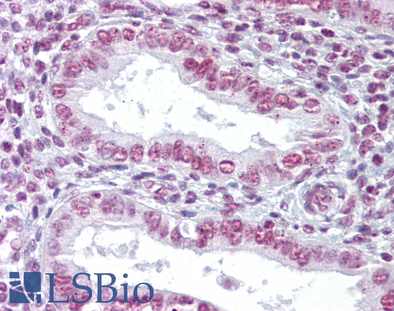 IHC-plus™ ZMYM3 Antibody