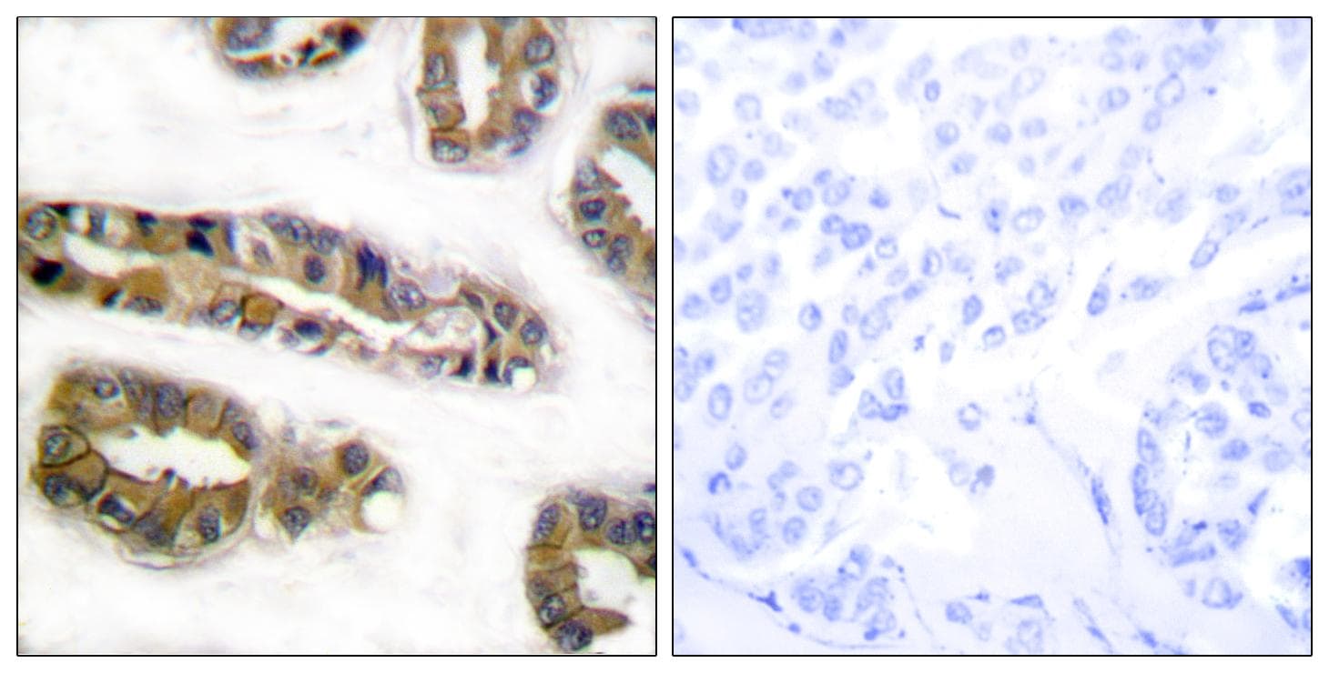 Polyclonal Rabbit anti-Human EGFR Antibody (p1016, IHC, IF, WB)