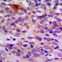 Polyclonal Rabbit anti-Human ARRDC4 Antibody (Internal, IHC, IF, WB)