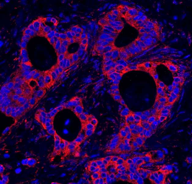 PBXIP1 / HPIP Antibody (aa1-50)