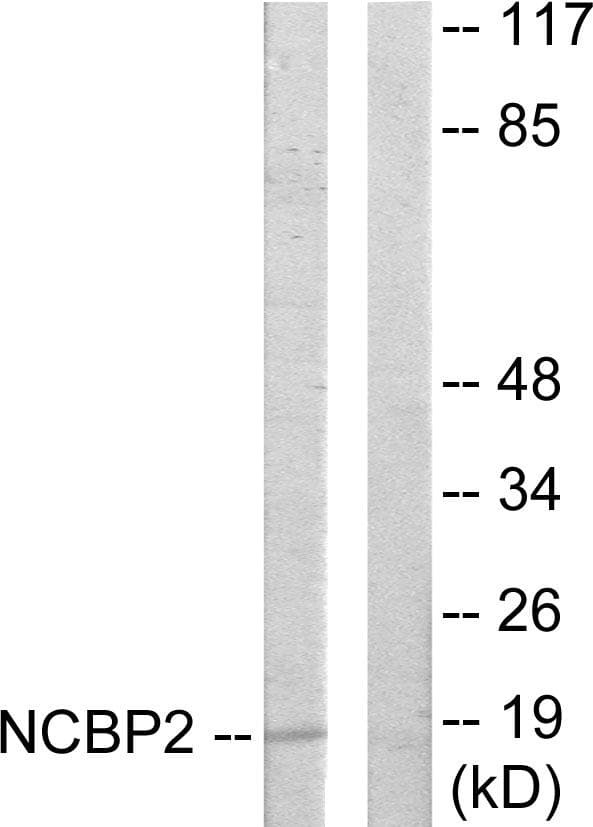 Polyclonal Rabbit anti-Human NCBP2 / CBP20 Antibody (WB)