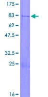 Human TSEN34 Protein (Recombinant GST)
