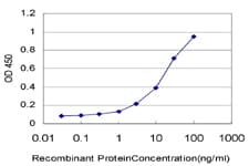 RPS23 / Ribosomal Protein S23 Antibody (clone 1E3)