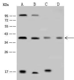 HIF1AN Antibody (Preservative Free)