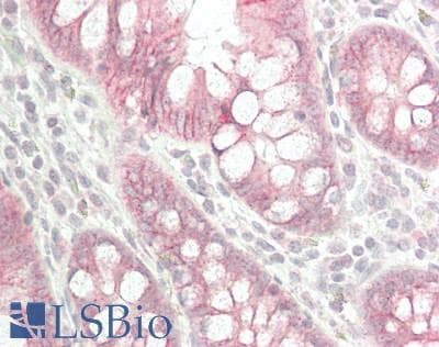 IHC-plus™ CTNNB1 / Beta Catenin Antibody