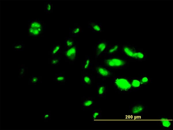 Monoclonal Mouse anti-Human FOXA1 Antibody (clone 1B1, IHC, IF, WB)