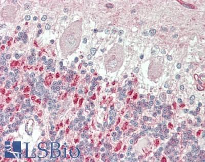 IHC-plus™ Polyclonal Rabbit anti-Human SPTBN2 Antibody (aa2340-2390, IHC, WB)