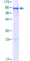 Human MIEF2 / SMCR7 Protein (Recombinant GST)