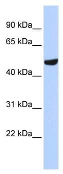Polyclonal Rabbit anti-Human SEPT11 / Septin 11 Antibody (N-Terminus, IHC, WB)