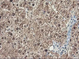 UNG / Uracil DNA Glycosylase Antibody (clone OTI2C12)