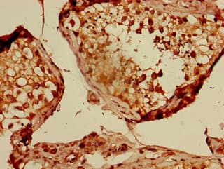Polyclonal Rabbit anti-Human CUL2 / Cullin 2 Antibody (IHC, WB)
