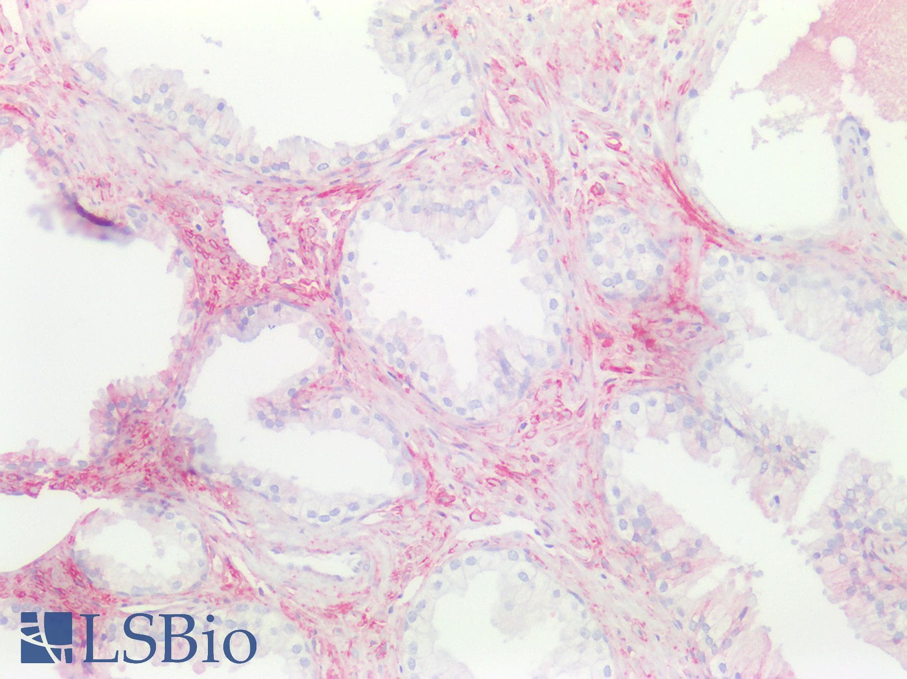 PathPlus™ Monoclonal Mouse anti-Human CD81 Antibody (clone 1.3.3.22, IHC, WB)