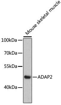 ADAP2 / CENTA2 Antibody