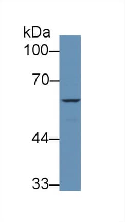 F9 / Factor IX Antibody (aa232-455)