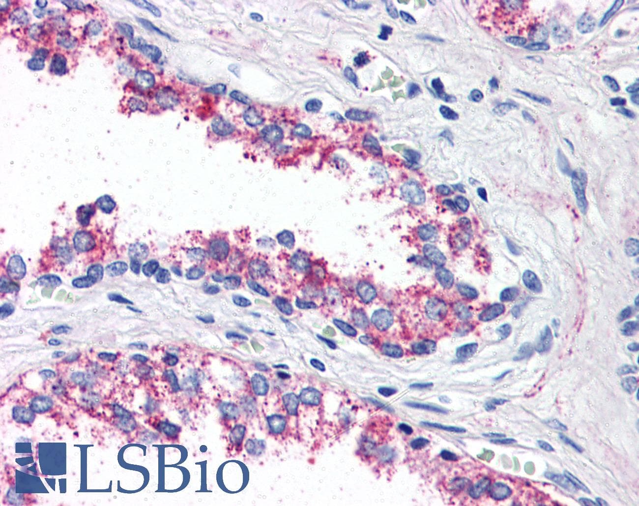 IHC-plus™ HTR1B / 5-HT1B Receptor Antibody (Internal)