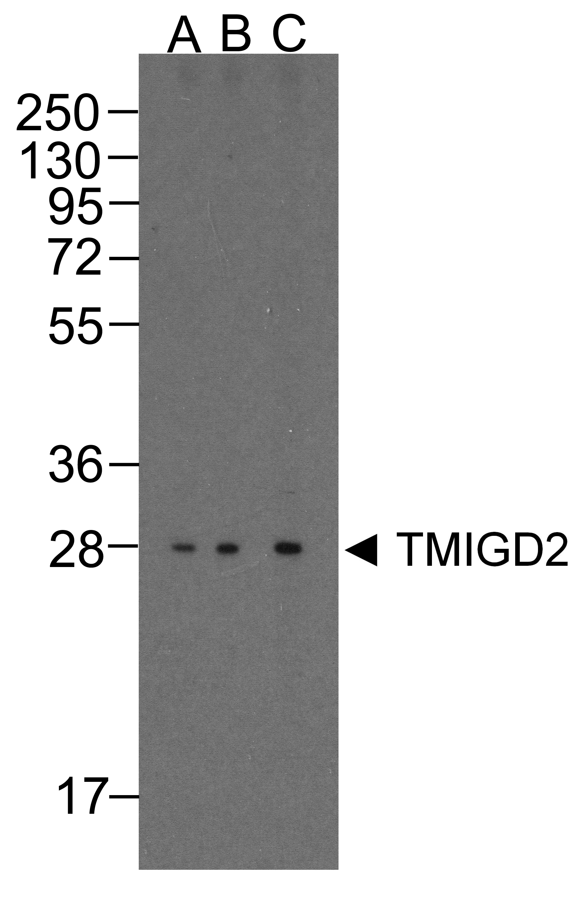 IHC-plus™ TMIGD2 Antibody (clone 8A1)