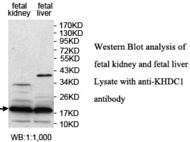 KHDC1 / C6orf148 Antibody (aa28-158)