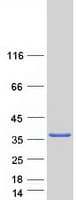 Human SULT1C4 / Sulfotransferase 1C4 Protein (Recombinant Myc-DDK (Flag))