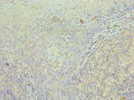 Polyclonal Rabbit anti-Human CCT3 Antibody (aa1-300, IHC, WB)