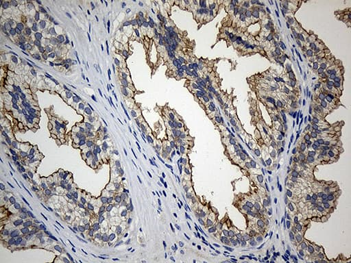 CIB1 / KIP Antibody (aa2-191, clone OTI1B8)