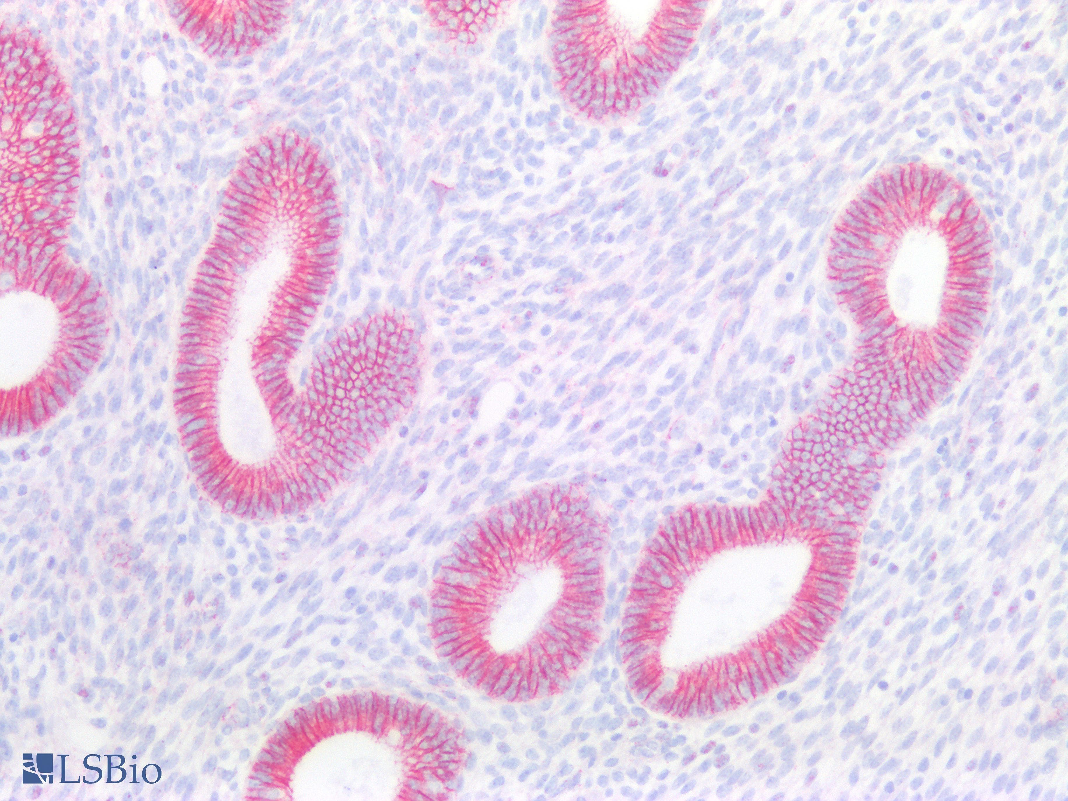 PathPlus™ CTNNB1 / Beta Catenin Antibody (C-Terminus)