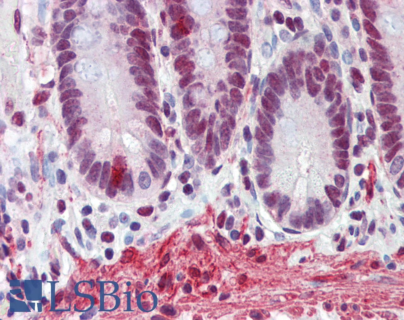 FUS / TLS Antibody (N-Terminus)