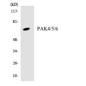 Polyclonal Rabbit anti-Human PAK4 + PAK5 + PAK6 Antibody (aa420-469, WB)