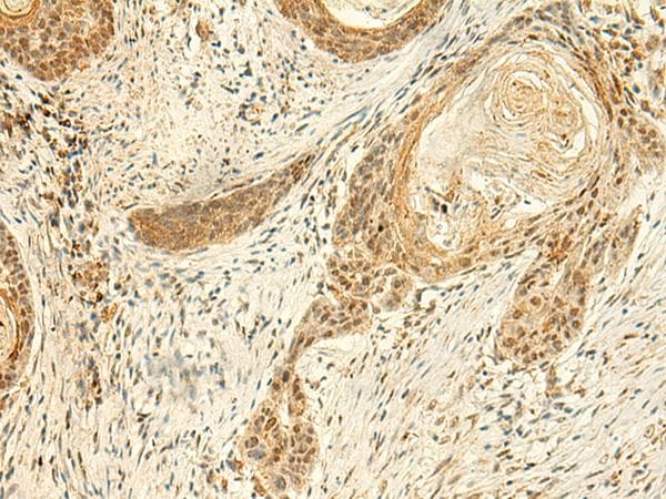 ARL4D Antibody